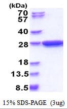 Schistosoma japonicum GST / Glutathione S-Transferase Protein (Recombinant)