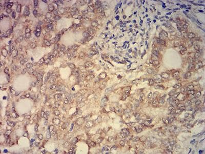 KAT2B / PCAF Antibody (clone 7D12C8)