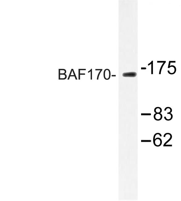 Polyclonal Rabbit anti-Human SMARCC2 Antibody (Met388, IF, WB)