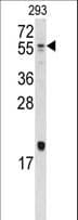 PathPlus™ BMP10 Antibody (aa7-35)