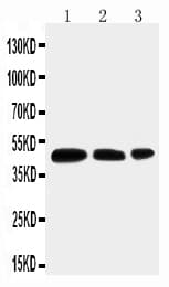 AQP2 / Aquaporin 2 Antibody (aa245-260)