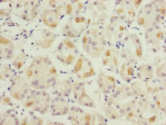LYSMD1 Antibody