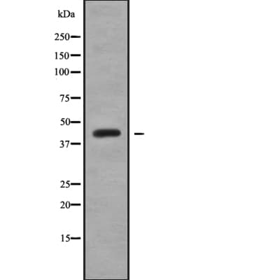 PIPOX / Sarcosine Oxidase Antibody
