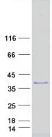 Human SIAH2 Protein (Recombinant Myc-DDK (Flag))