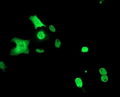 Monoclonal Mouse MYC / c-Myc Antibody (aa408-432, IF, WB)