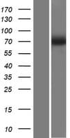 SLC23A2 / SVCT2 Protein (Over-Expression Lysate Myc-DDK (Flag))
