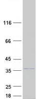 Human SLC25A42 Protein (Recombinant Myc-DDK (Flag))