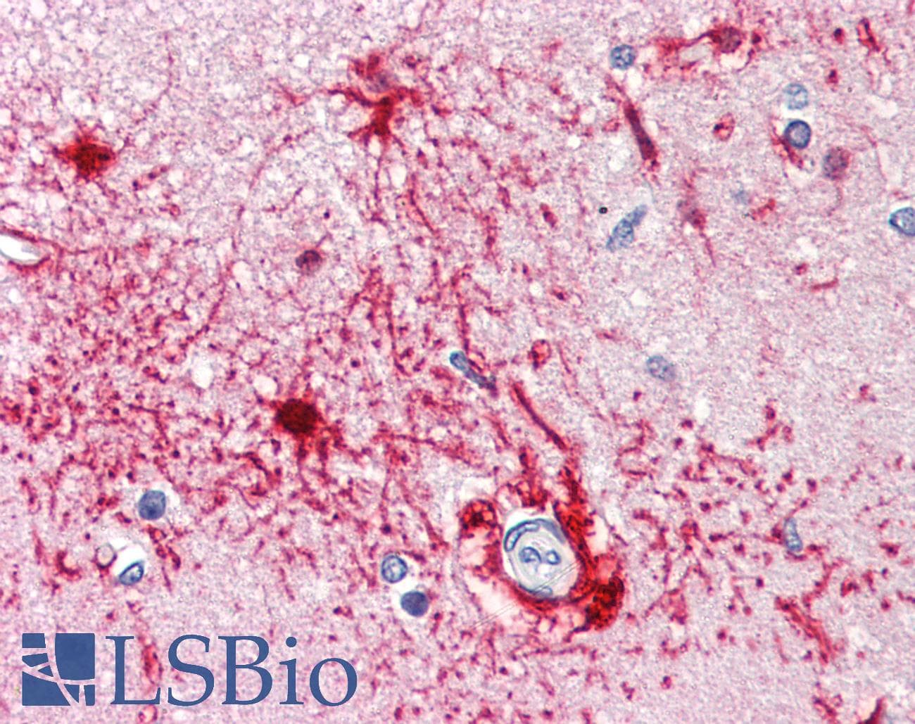 IHC-plus™ Monoclonal Mouse anti-Human FABP7 / BLBP / MRG Antibody (clone AT1D1, aa1-132, IHC, WB)