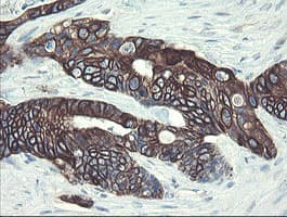 DPH2 Antibody (clone OTI3A12)