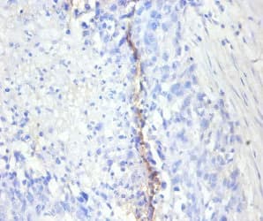 MKI67 / Ki67 Antibody