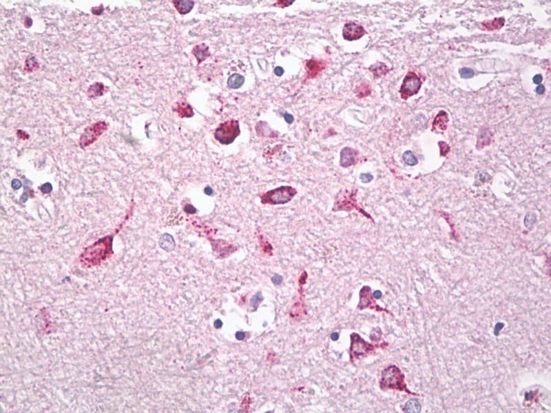 Polyclonal Rabbit anti-Human GGH / Gamma-Glutamyl Hydrolase Antibody (C-Terminus, IHC, WB)
