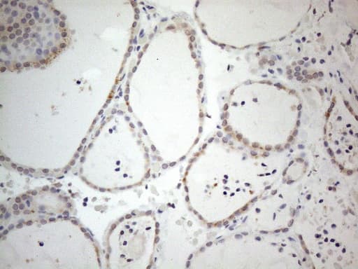IRS1 Antibody (aa1-280, clone OTI2B10)