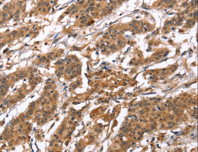 Polyclonal Rabbit anti-Human BNIP2 Antibody (IHC)