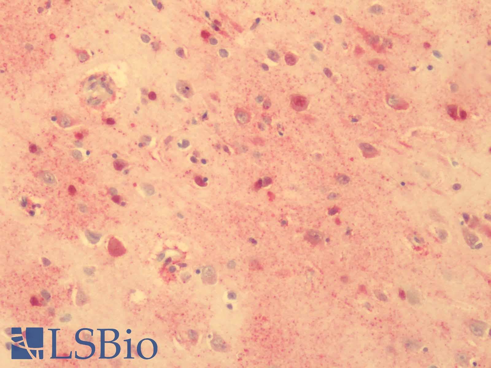 IHC-plus™ ADGRG1 / GPR56 Antibody (Cytoplasmic Domain)