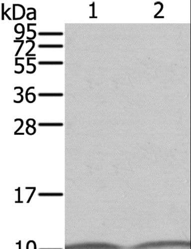 Polyclonal Rabbit anti-Human S100A6 / Calcyclin Antibody (WB)