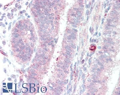 IHC-plus™ DIXDC1 Antibody (aa100-150)