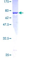 Human MAT / MAT1A Protein (Recombinant GST)