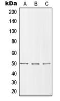 SLC39A7 / ZIP7 Antibody (Internal)