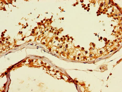 Polyclonal Rabbit anti-Human CCT8 Antibody (IHC, IF, WB)