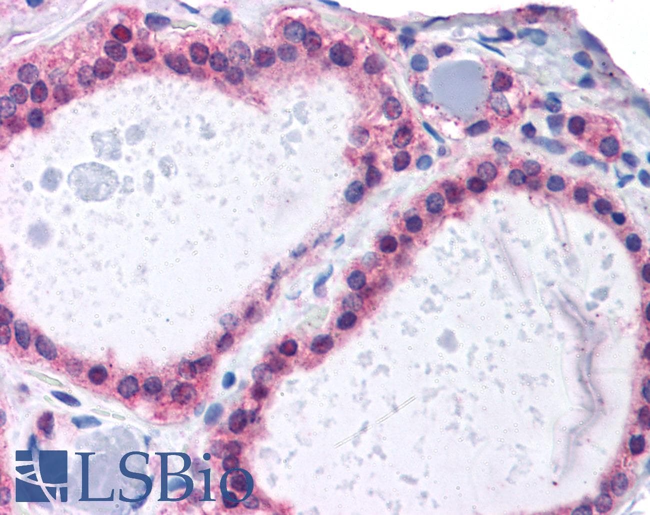 IHC-plus™ ADAM17 / TACE Antibody (C-Terminus)
