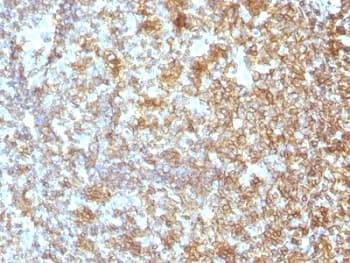 CD45RA Antibody (clone SPM504)