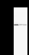 MATR3 / Matrin 3 Antibody (clone 2539C3a)