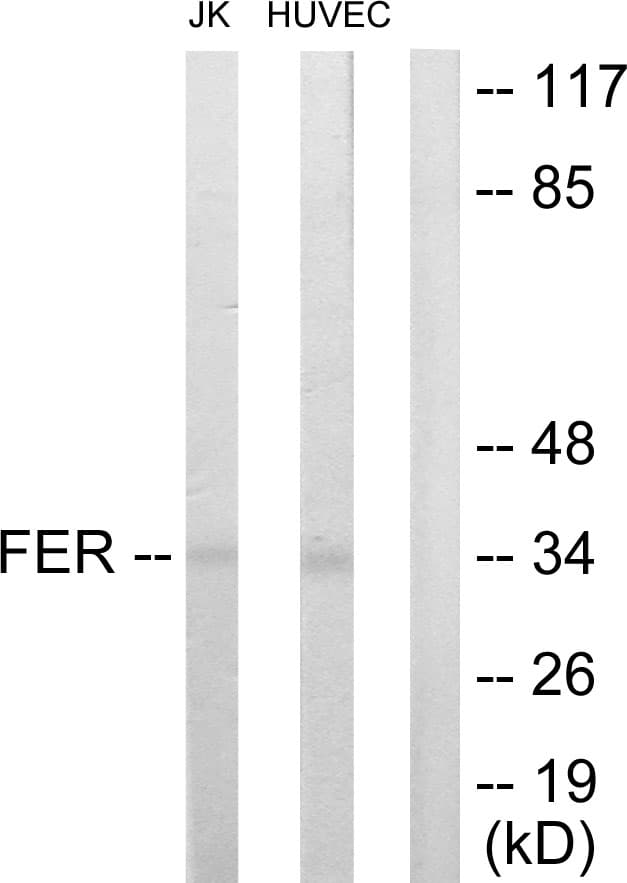 FER Antibody (aa766-815)