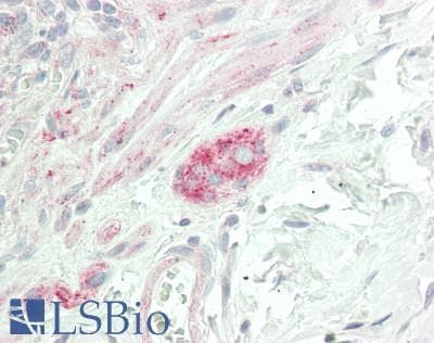 IHC-plus™ Polyclonal Rabbit anti-Human CHRNA9 Antibody (aa8-42, IHC, WB)
