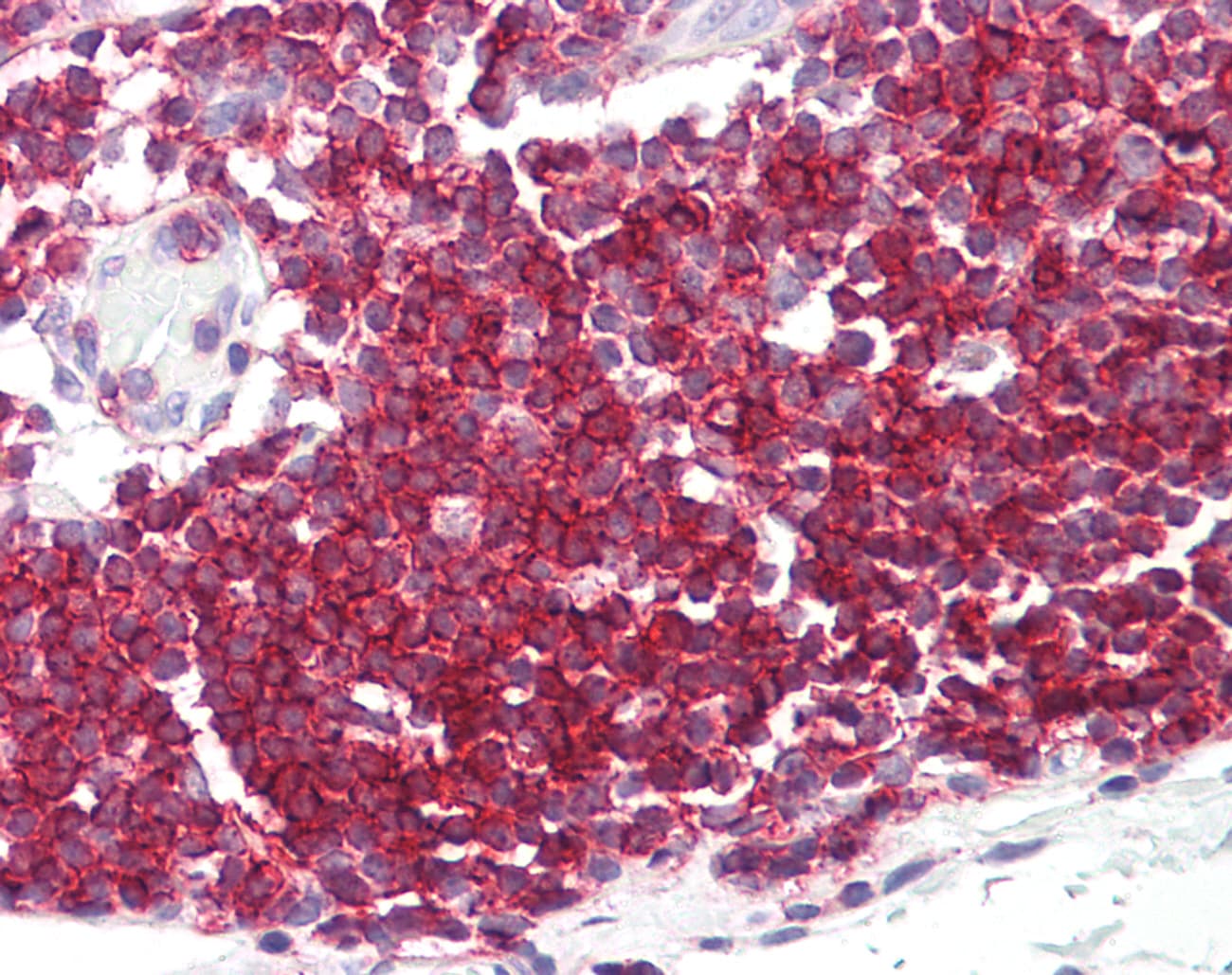 SEPT9 / Septin 9 Antibody (C-Terminus)