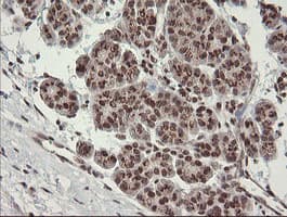 NUMB Antibody (clone OTI4F3, Carrier-free)