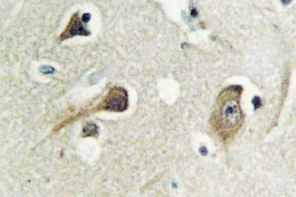 Polyclonal Rabbit anti-Human YWHAG / 14-3-3 Gamma Antibody (Met81, IHC, IF, WB)