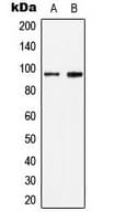 STAT6 Antibody (phospho-Tyr641)