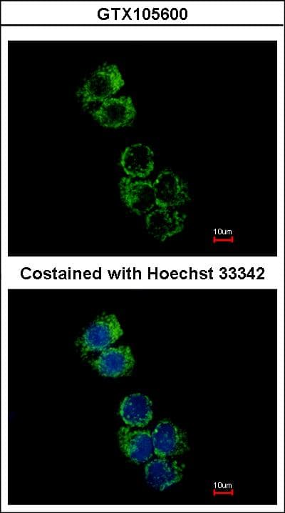 IHC-plus™ Polyclonal Rabbit anti-Human GSTA2 Antibody (aa1-196, IHC, WB)