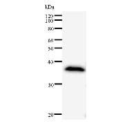 ANKRD11 Antibody (clone 2022C8a)