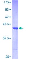 Human ARF3 Protein (Recombinant GST)