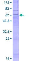 Human CYSLTR1 / CYSLT1 Protein (Recombinant GST)