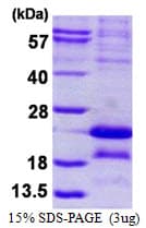 Human MAGEA5 Protein (Recombinant His)