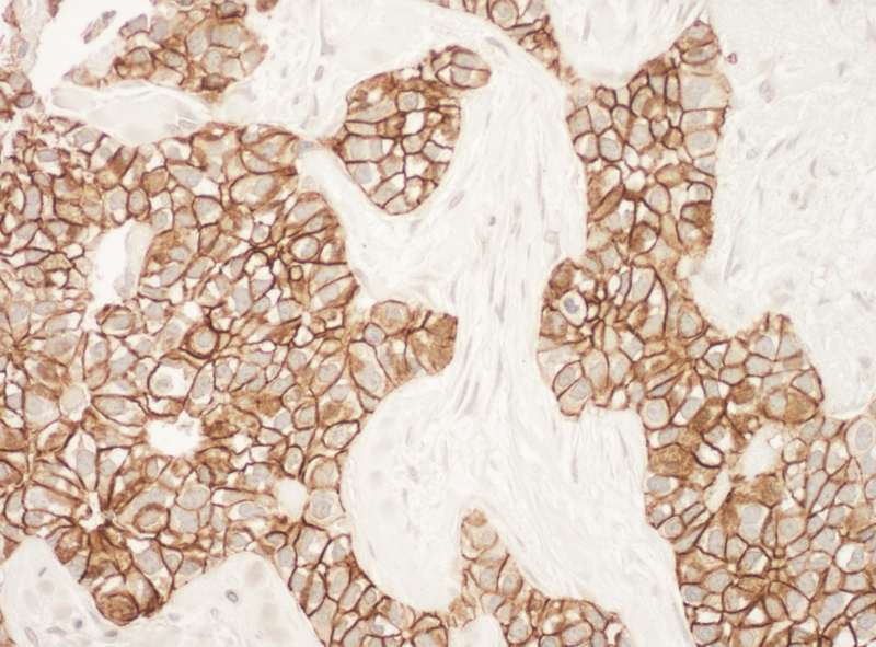 ERBB2 / HER2 Antibody (aa1200-C-term)