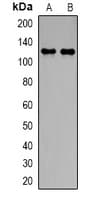 Polyclonal Rabbit anti-Human SLC4A4 / NBC1 Antibody (IHC, WB)