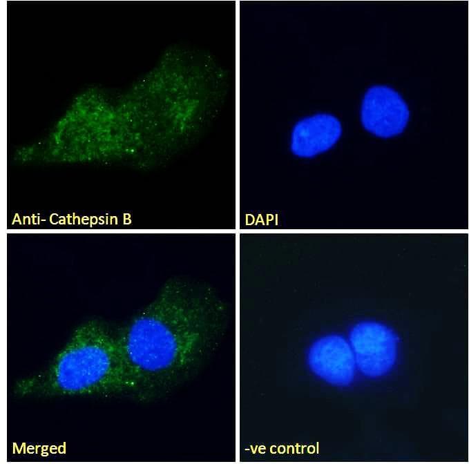 IHC-plus™ Polyclonal Goat anti-Human CTSB / Cathepsin B Antibody (Internal Region, IHC, IF)