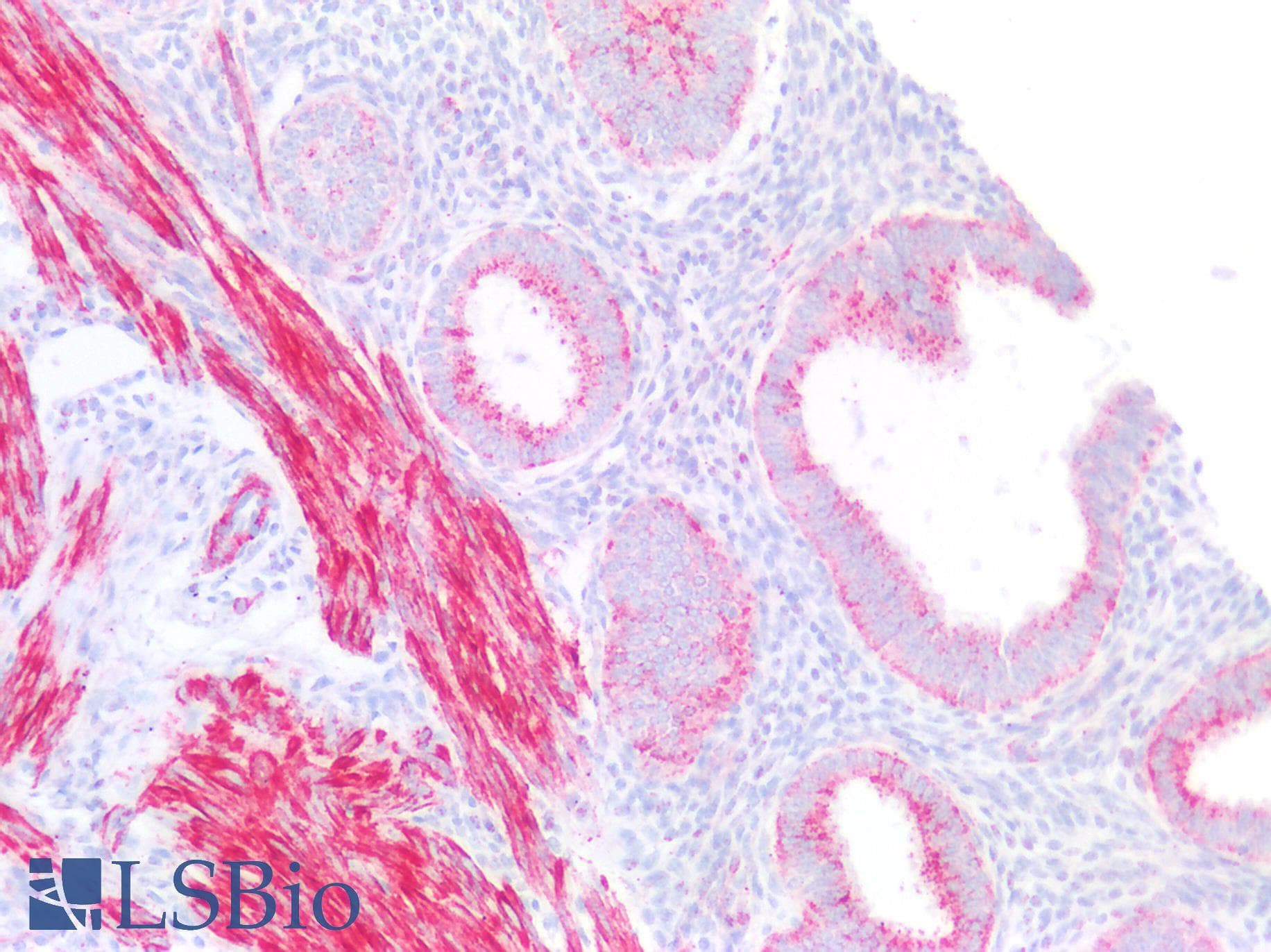 PathPlus™ CPM / Carboxypeptidase M Antibody (aa64-113)