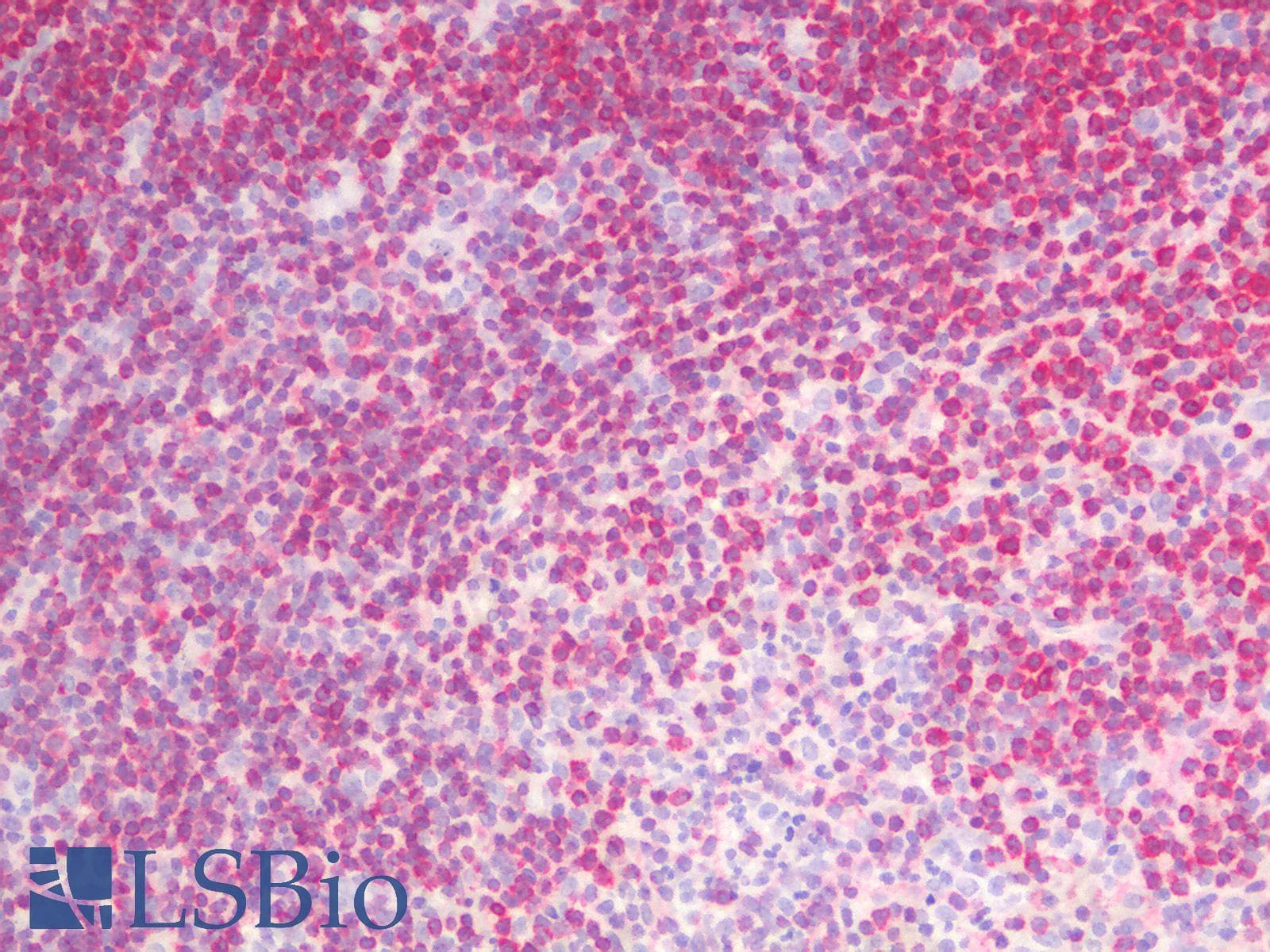 PathPlus™ BCL2 / Bcl-2 Antibody (clone rBCL2/782)