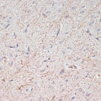 SLC6A3 / Dopamine Transporter Antibody
