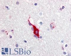 PathPlus™ Polyclonal Rabbit anti-Human TRPA1 Antibody (Internal, IHC, IF)