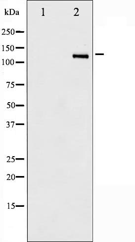 Polyclonal Rabbit anti-Human HDAC6 Antibody (phospho-Ser22, IHC, IF, WB)