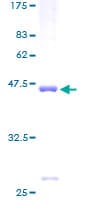 Human RPS11 / Ribosomal Protein 11 (Recombinant GST)