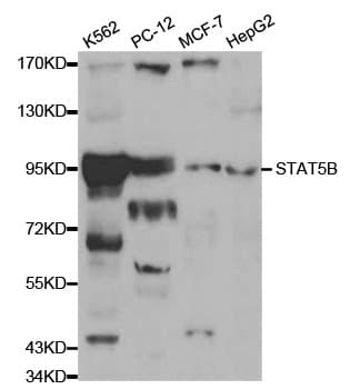 STAT5B Antibody