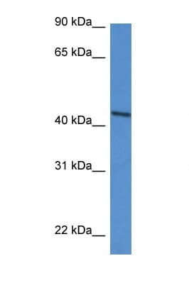 DDO / D-Aspartate Oxidase Antibody (aa91-140)