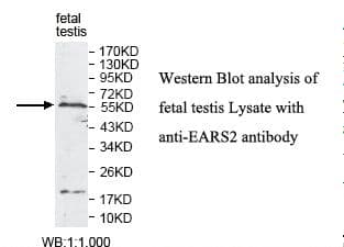 KIAA1970 / EARS2 Antibody (aa22-253)