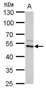 IHC-plus™ AZIN2 / Antizyme Inhibitor 2 Antibody (Internal)